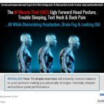 Forward Head Posture FIX Forward Head Posture