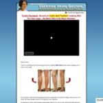 Varicose Veins Natural Alternative Home Remedies, Herbal & Treatment Help – Spider Veins Cure Ways Varicose Veins Natural Alternative Home Remedies, Herbal & Treatment Help - Spider Veins Cure Ways