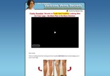 Varicose Veins Natural Alternative Home Remedies, Herbal & Treatment Help – Spider Veins Cure Ways Varicose Veins Natural Alternative Home Remedies, Herbal & Treatment Help - Spider Veins Cure Ways