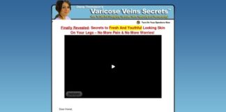 Varicose Veins Natural Alternative Home Remedies, Herbal & Treatment Help – Spider Veins Cure Ways Varicose Veins Natural Alternative Home Remedies, Herbal & Treatment Help - Spider Veins Cure Ways