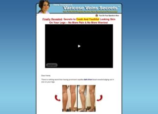 Varicose Veins Natural Alternative Home Remedies, Herbal & Treatment Help – Spider Veins Cure Ways Varicose Veins Natural Alternative Home Remedies, Herbal & Treatment Help - Spider Veins Cure Ways